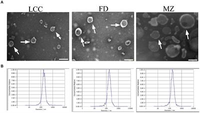 Anti-fibrotic effect of extracellular vesicles derived from tea leaves in hepatic stellate cells and liver fibrosis mice